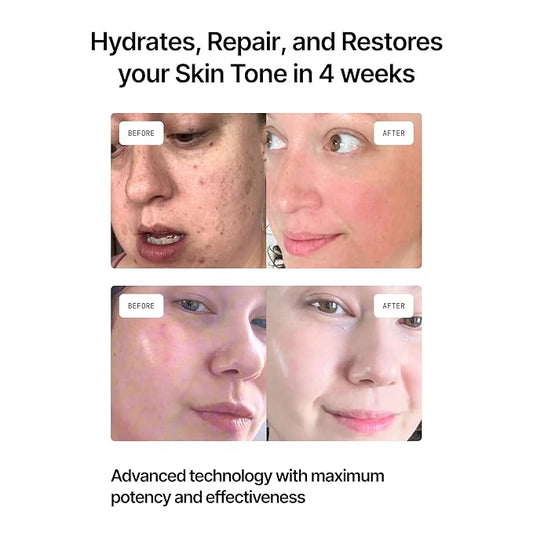 GENIX Beauty Face Cream - Anti-Aging, Anti-Wrinkle, Vitamin C & Firming Moisturizer, Clinically Proven Skincare to Hydrate, Repair, and Restore Skin. Fragrance-Free, for All Skin Types - 1 FL OZ