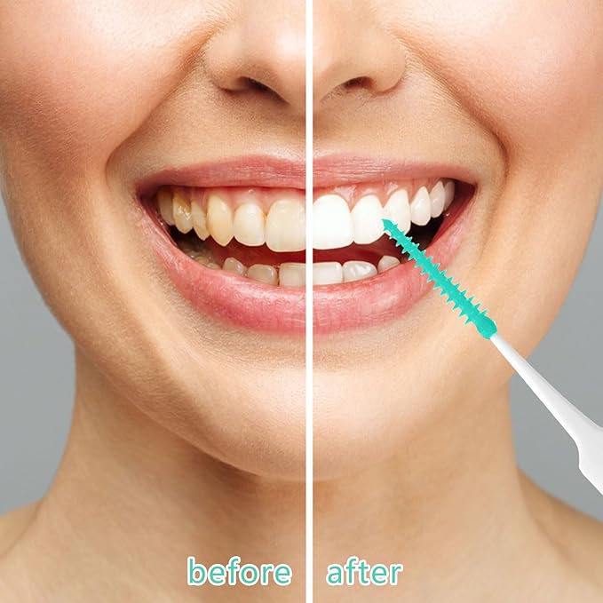 100 Pieces Interdental Brushes, Silicone Dental Floss Picks with Case Dental Brushes Dental Picks Green Tooth Floss Picks for Teeth Cleaning(Green)