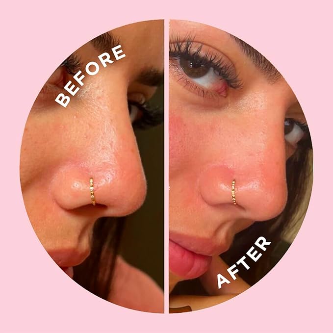 ZitSticka Pimple Patches for Face and Body, Goo Getter Hydrocolloid Patches to Cover Zits & Blemishes, Acne Patches or Zit Spot Stickers, Body Blemish Patch (Nose Strip Pack 8 Pack)