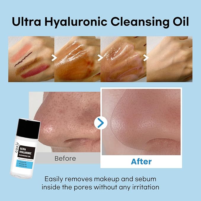 [Travel KIT] coxir Ultra HYALURONIC/Cleansing Oil+Toner+ampoule+Cream Holiday Miniature/[2.68 fl.oz (Pack of 1)] / Korean Skin Care