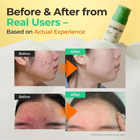 Watery Sulfur Pore Cleansing Powder, Korean Enzyme & Rice Powder & PHA Face Wash for Blackhead Removal, Sensitive and Acne-Prone Skin, Radiant Glow, Bumpy skin (1.76 oz / 50g)