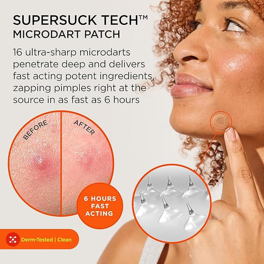 ZitSticka Killa Pimple Patches for Face - World's Most Potent Pimple Patch with Fast-Acting Microdarts - Starts Working within 6 Hours for Deep, Early-Stage Zits - Mini 16 Count